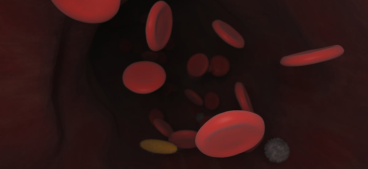 anemia feripriva